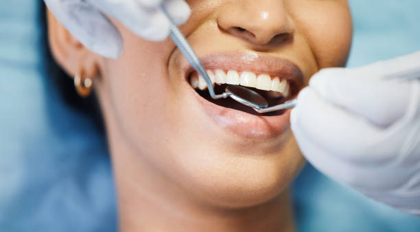 Best Broken Tooth Emergency  in Springville, VA